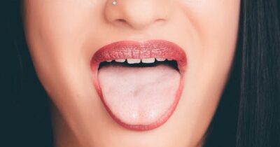 Tongue ulcer in Hindi