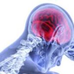 What is Brain Injury