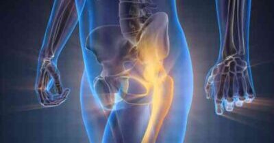 Lumber Disc Replacement Surgery