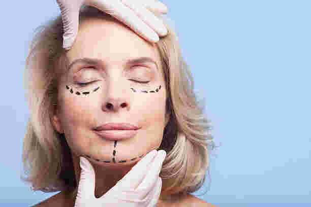 elective cosmetic surgery